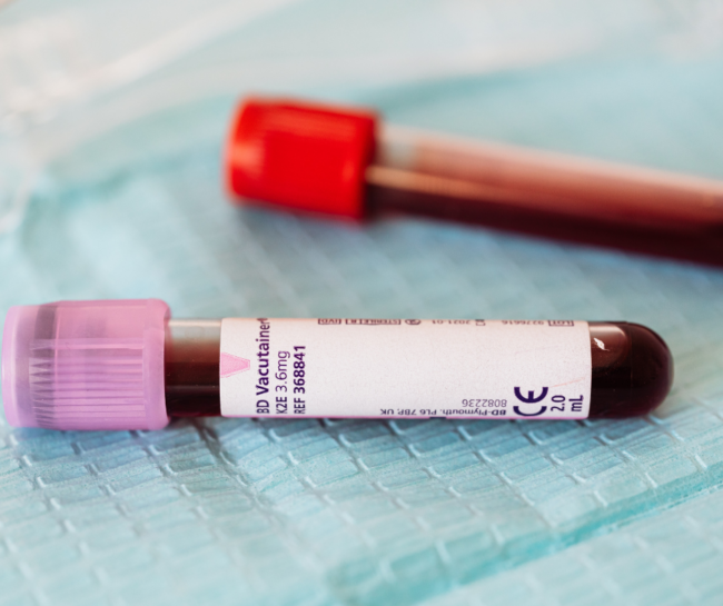 Optimize These Two Blood Tests to Protect Your Brain From Dementia with Authentic Health.