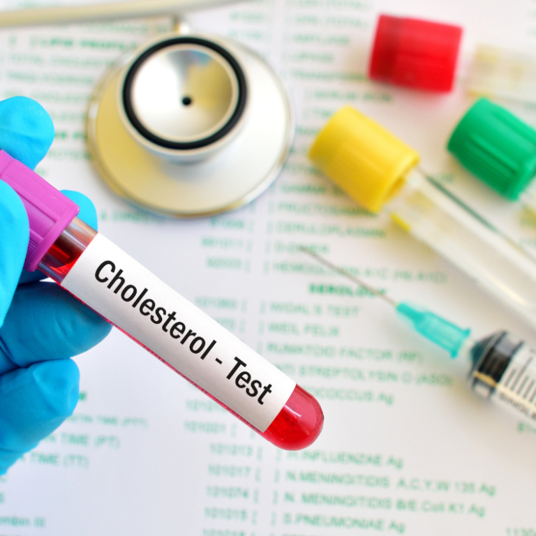 Cholesterol testing at Authentic Health in Asheville NC.