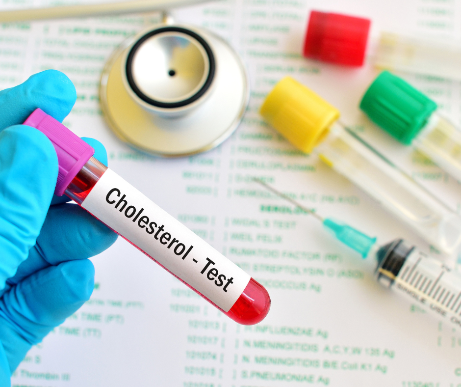Cholesterol testing at Authentic Health in Asheville NC.