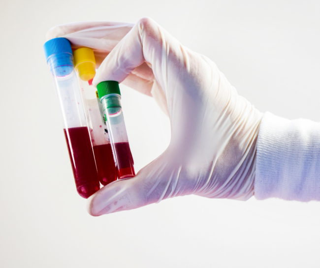 Learn how multi-cancer early detection blood tests may identify cancer earlier, which cancers they can detect, and why they don't replace routine screening.