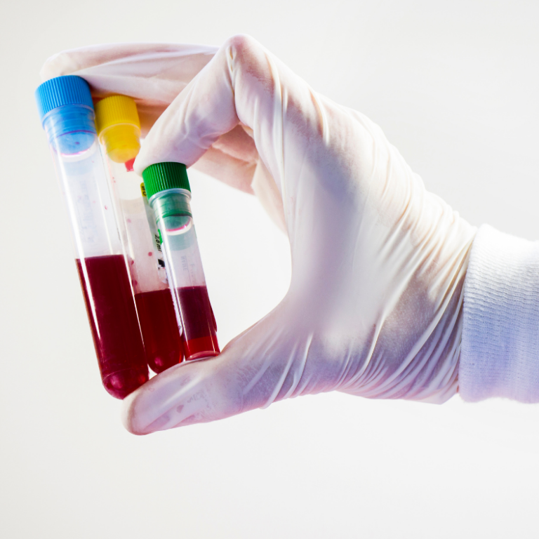 Learn how multi-cancer early detection blood tests may identify cancer earlier, which cancers they can detect, and why they don't replace routine screening.