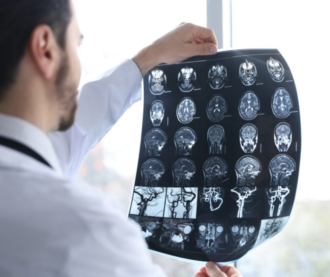 Brain health with authentic health