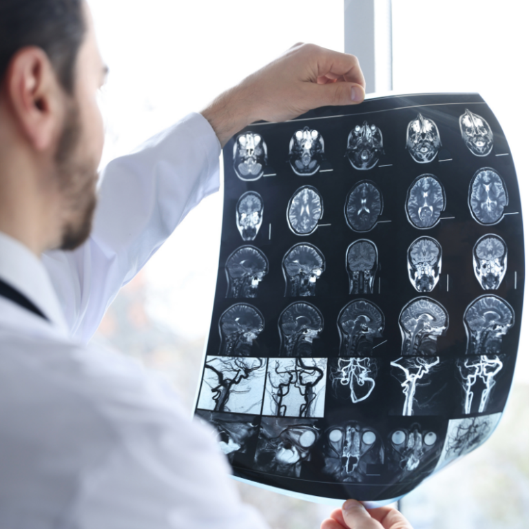 Brain health with authentic health